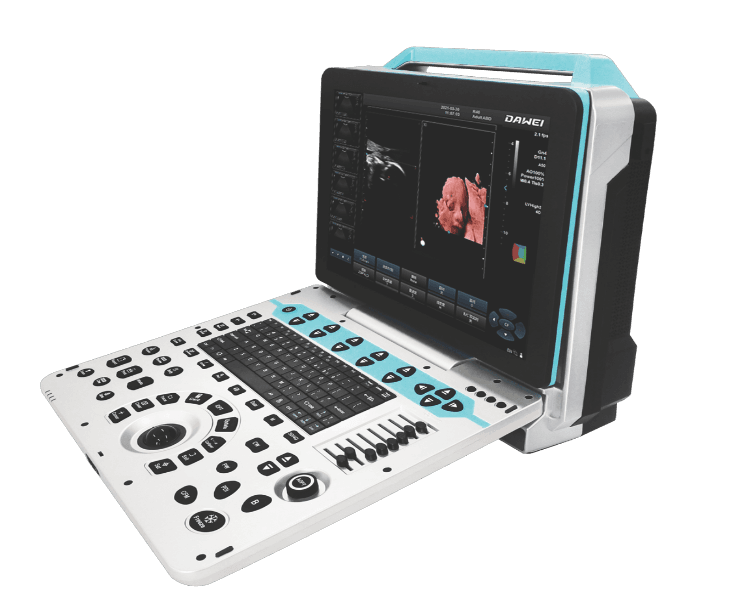 equipo ultrasonido portatil doppler color