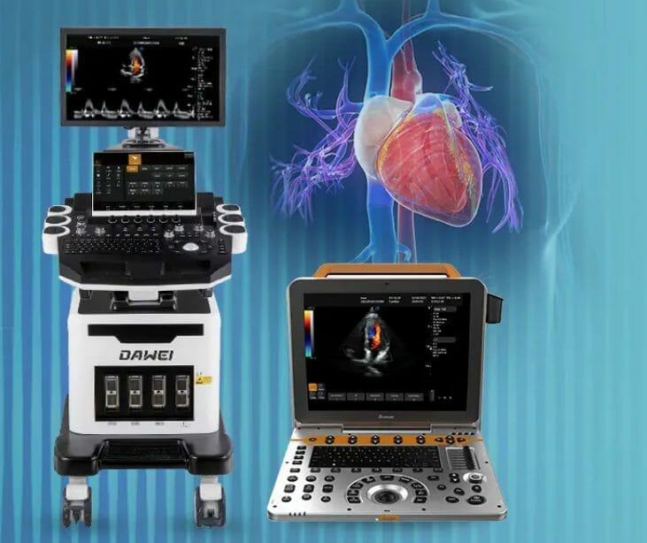 equipo de ultrasonido diagnostico