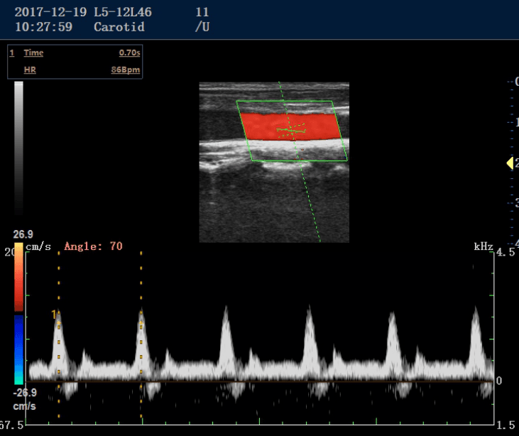Imagen de ultrasonido diagnostico