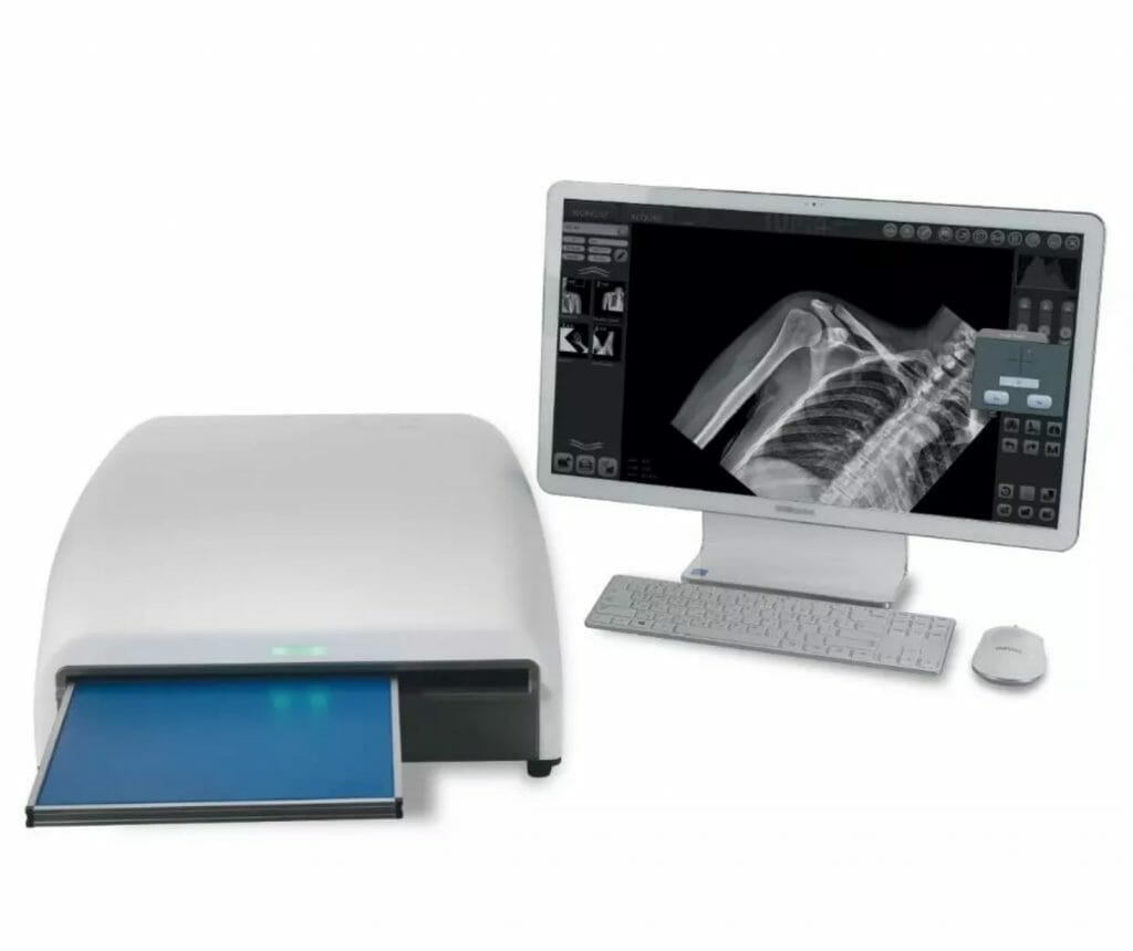 digitalizador rx computarizado